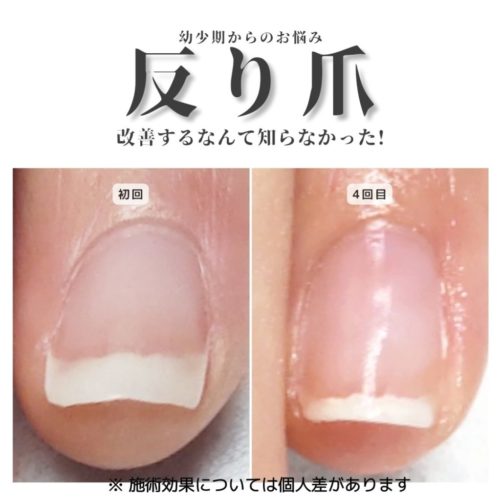 04-2　そり爪　育成前・結果